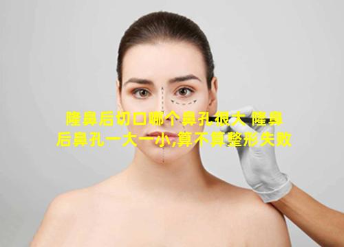 隆鼻后切口哪个鼻孔很大 隆鼻后鼻孔一大一小,算不算整形失败